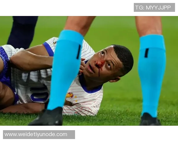 姆巴佩伤情加重带伤报到法国队黄潜之战脚踝扭伤影响状态